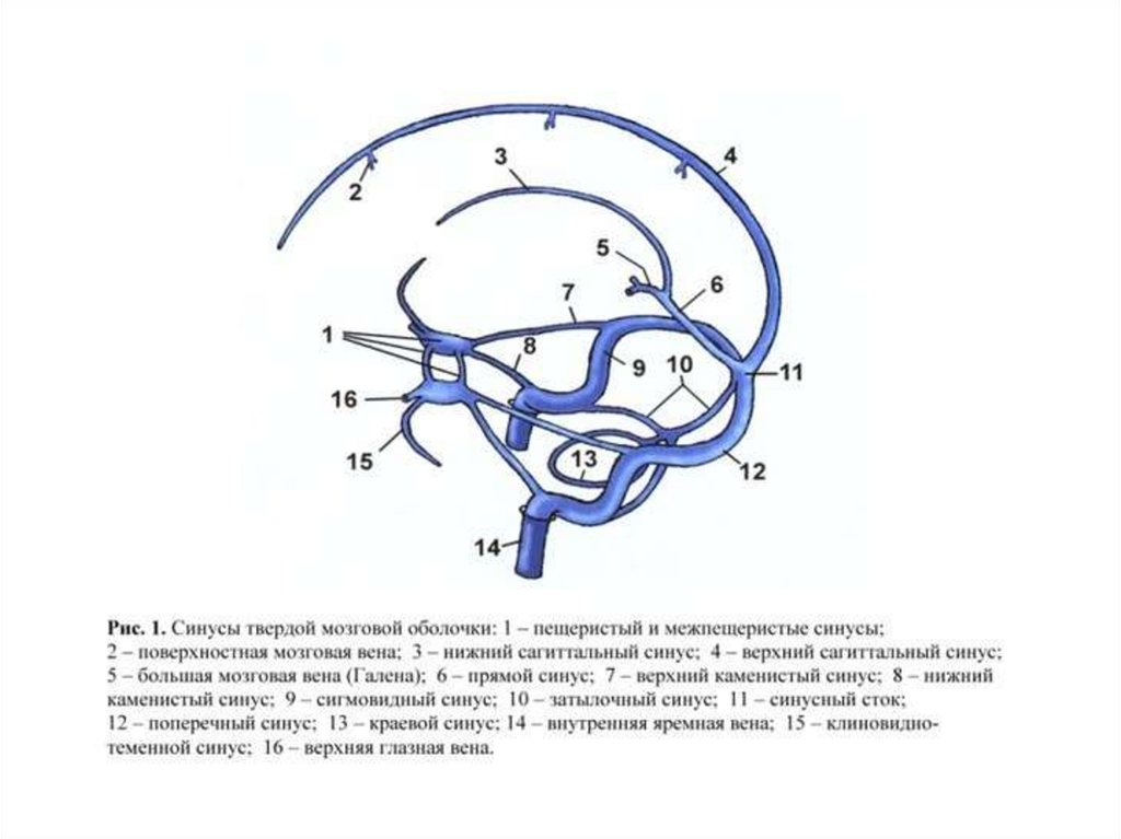 Синус оболочки мозга. Схема венозных синусов твердой мозговой оболочки. Синусы головного мозга схема. Синусы твердой оболочки мозга схема. Оболочки головного мозга и синусы твердой мозговой оболочки.