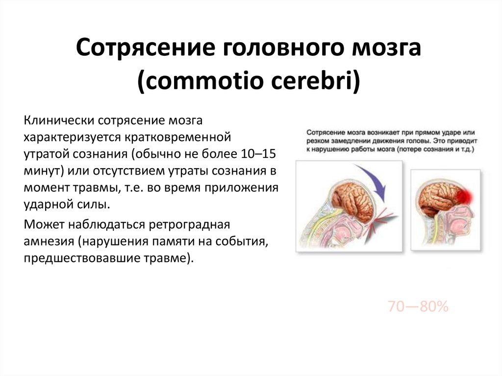 Сотрясение тканей. СГМ головного мозга при сотрясении. Сотрясение головного мозга патанатомия. Сотрясени еголовоного мозга. Сотрясение мозга характеризуют.