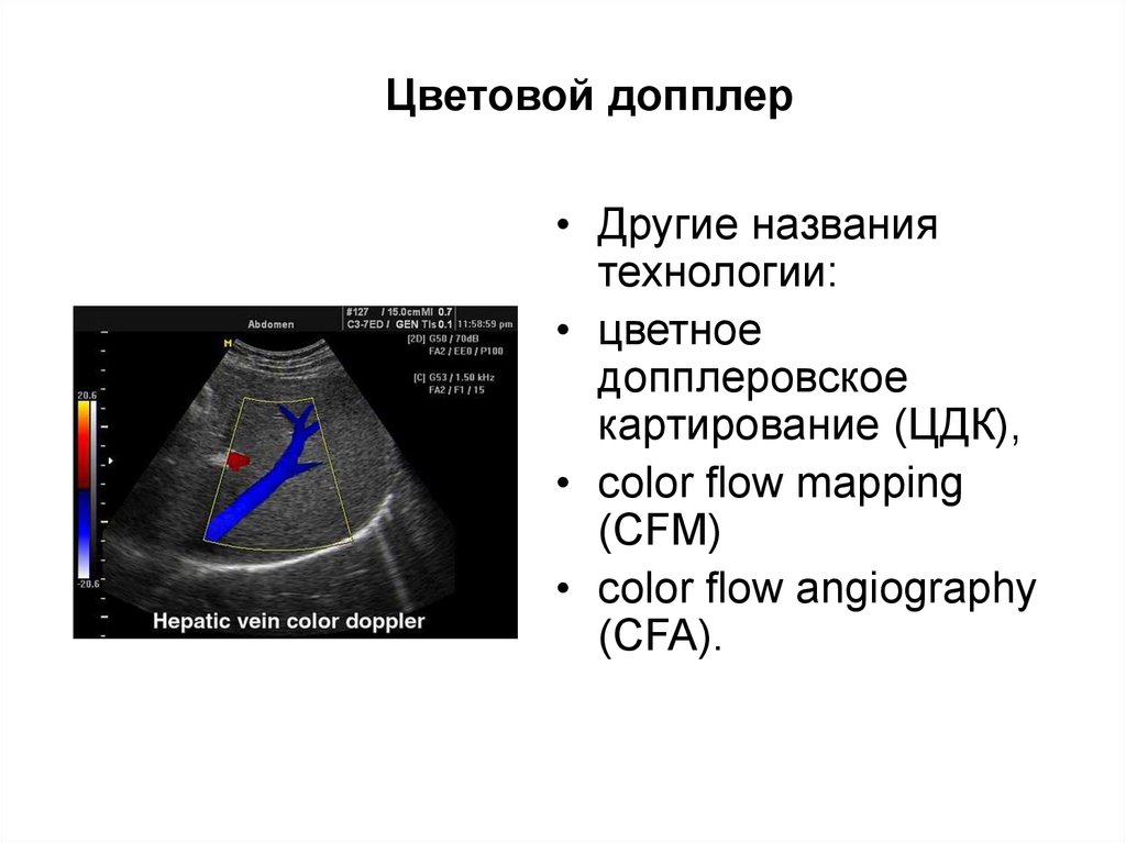 Узи с цдк брюшная. Цветное допплеровское картирование. ЦДК допплер. УЗИ С цветовым допплеровским картированием. УЗИ диагностика.