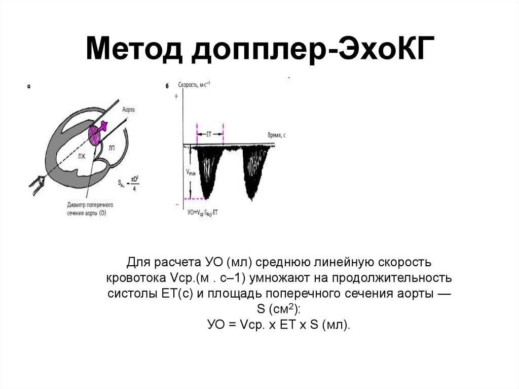 Доплер это. Эхокардиография принцип метода. Ударный объем сердца по ЭХОКГ. Допплер ЭХОКГ. Доплеровский режим ЭХОКГ.