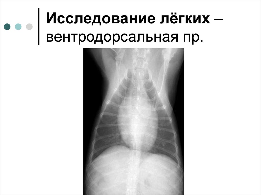 Исследование легких. Вентродорсальная проекция.