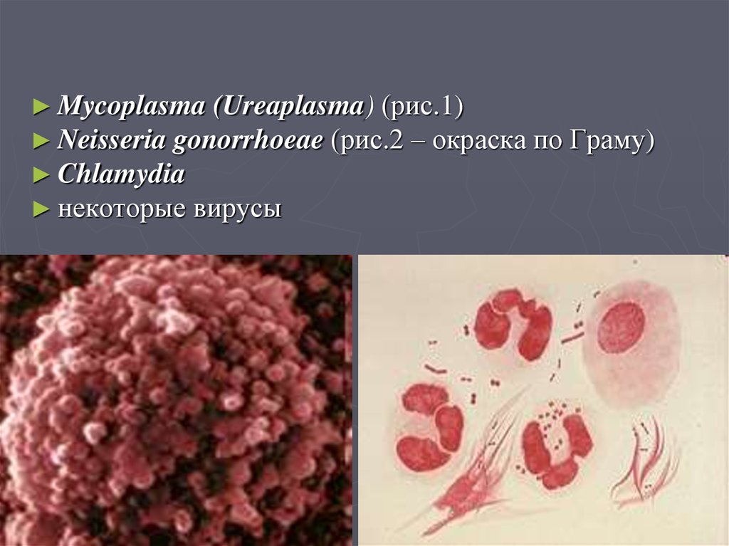 Chlamydia trachomatis neisseria gonorrhoeae. Микоплазма уреалитикум. Микоплазма и уреаплазма. Уреаплазма уреалитикум.
