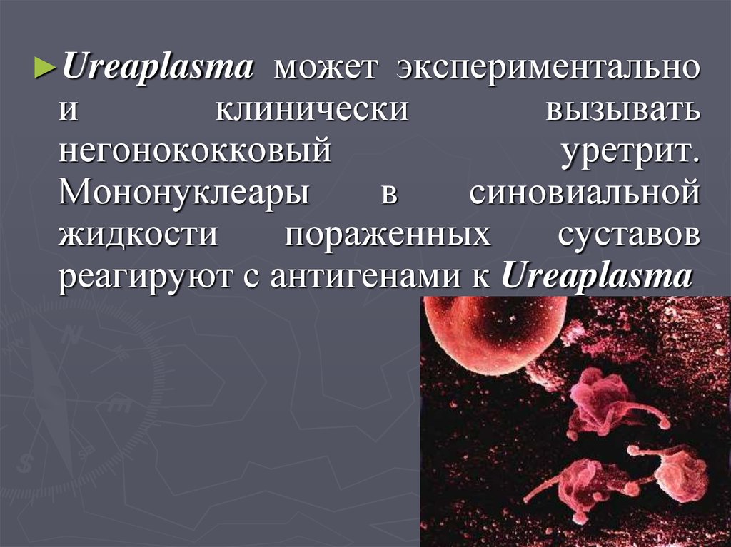 Неспецифический уретрит у женщин. Негонококковый уретрит.