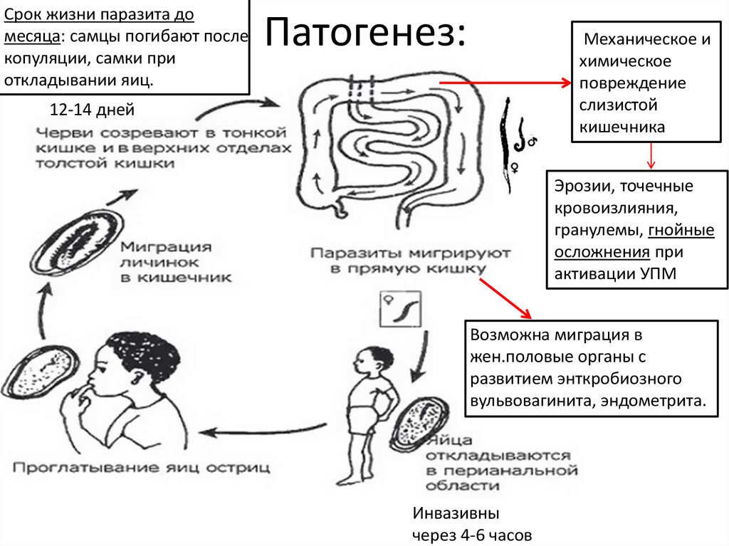 etiologia enterobiozei)