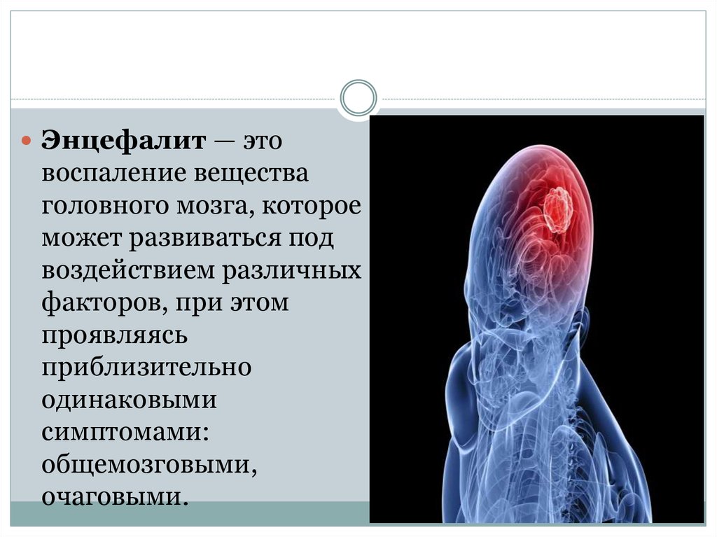 Клиническая картина энцефалита