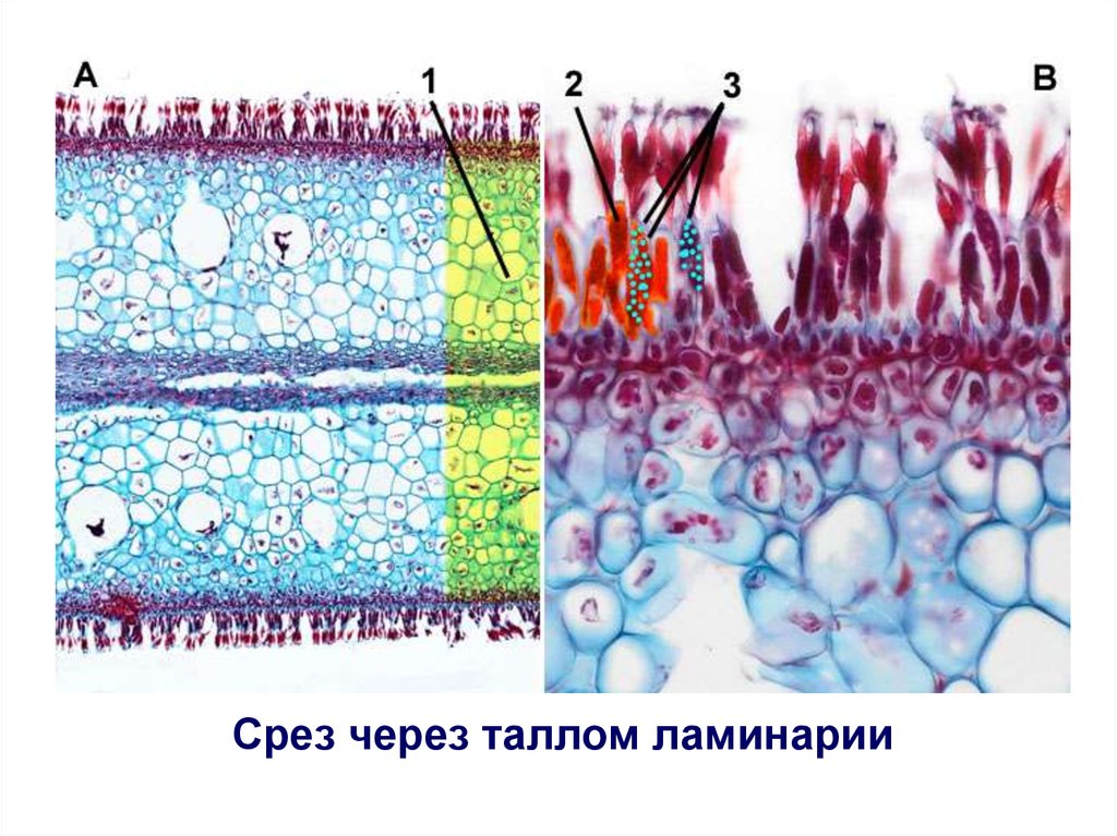 Ткани мхов. Слоевища ламинарии микроскопия. Парафизы бурых водорослей. Fucus algae микроскоп. Парафизы ламинарии.