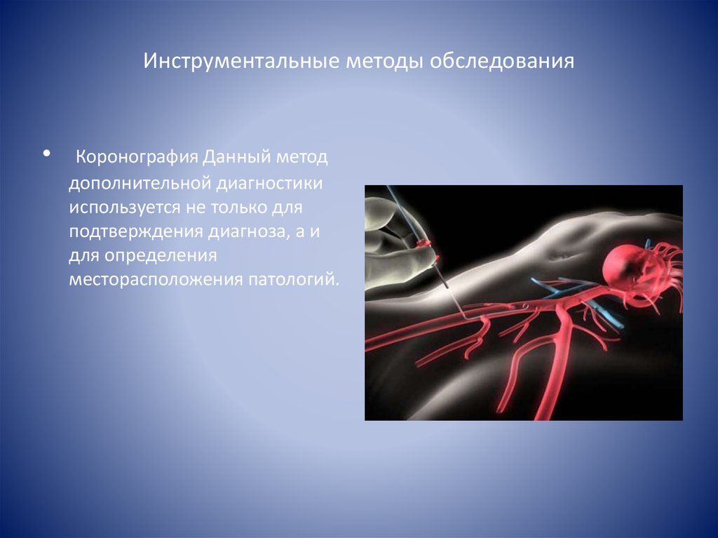 Рука после коронографии. Коронография сердца и последствия. Стенд для коронографии. Для чего делают коронографию.