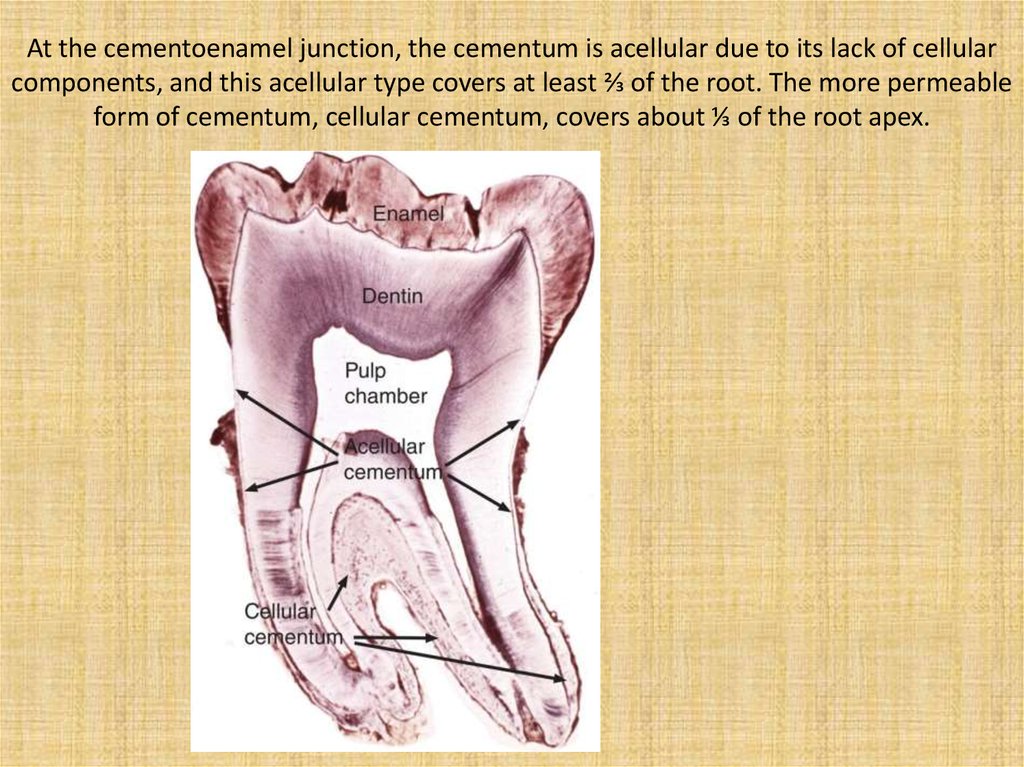 At the cementoenamel junction, the cementum is acellular due to its lack of cellular components, and this acellular type covers