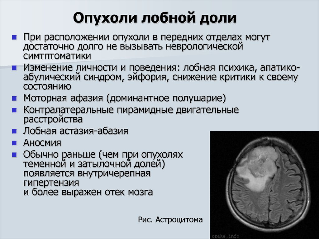 Диагноз опухоли головного