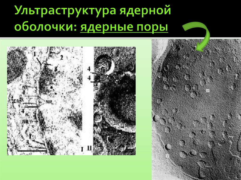 Растворение ядерной мембраны. Ядерная оболочка. Ультраструктура ядерной поры. Ядерная мембрана.