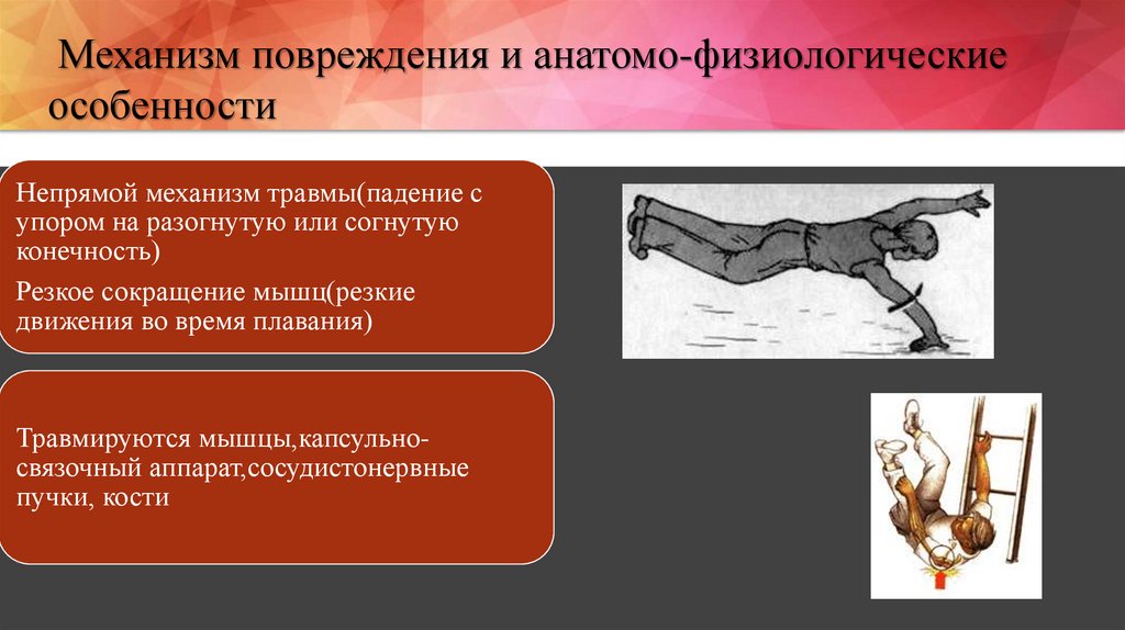 Привычный вывих плеча презентация