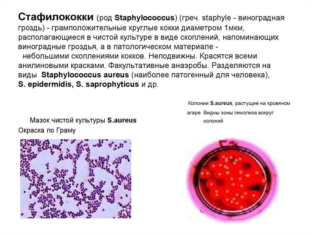 Staphylococcus aureus 4. Кокки стафилококки стрептококки. Грамположительные кокки патогенные. Грамположительные кокки. Стафилококки.. Грамположительные кокки микробиология.