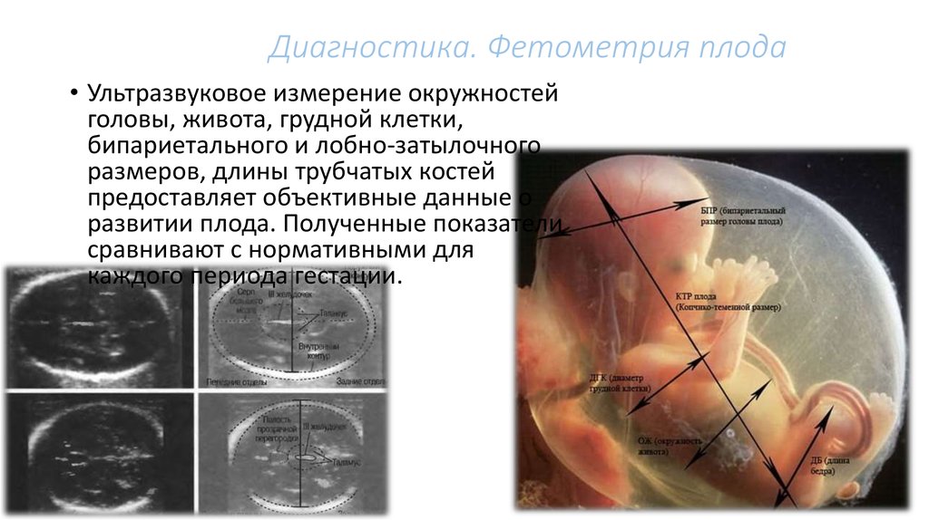 Беременность окружность головы. Измерение окружности головы плода по УЗИ. Контрольное УЗИ фетометрия. Измерение трубчатых костей плода. Анатомия плода БПР.