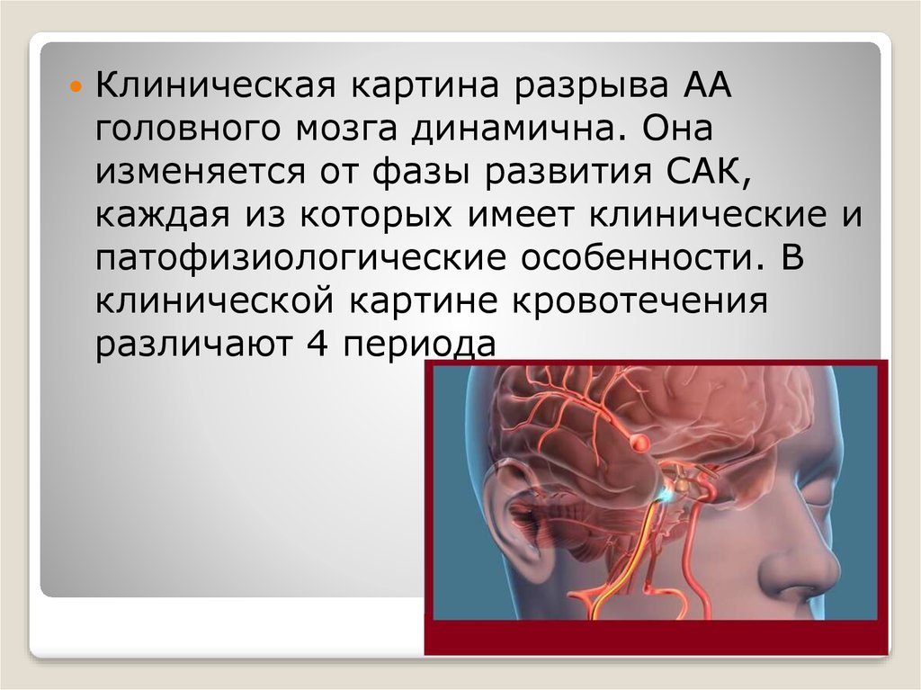 Аневризма мозга отзывы. Аневризма головного мозга. Разрыв сосуда в головном мозге. Аневризма сосудов головного мозга. Разрыв аневризмы головного мозга.