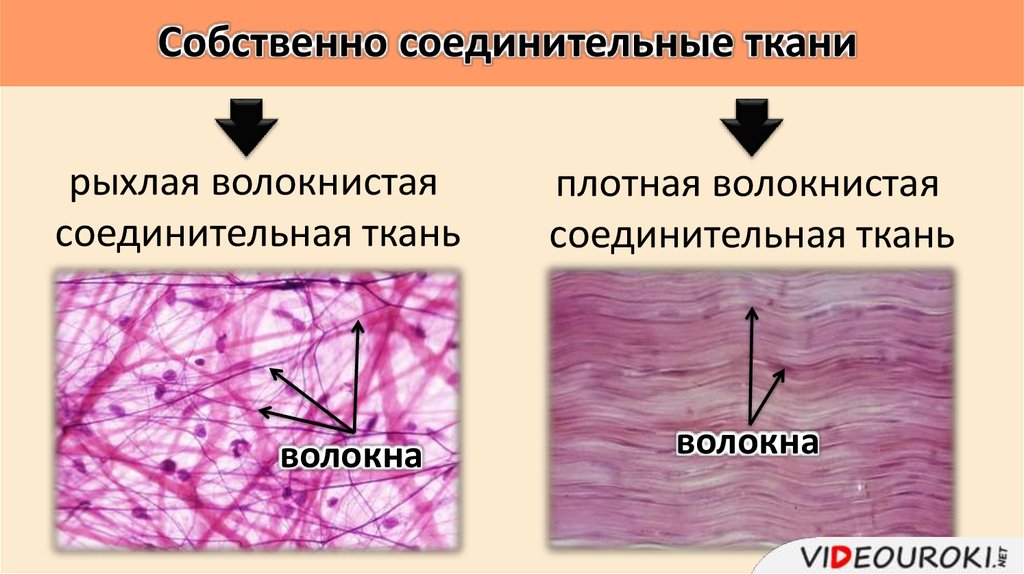 Собственная ткань. Соединительная ткань собственно соединительная волокнистая. Строение плотной волокнистой соединительной ткани. Собственно соединительная рыхлая волокнистая ткань. Рыхлая и плотная соединительная ткань.