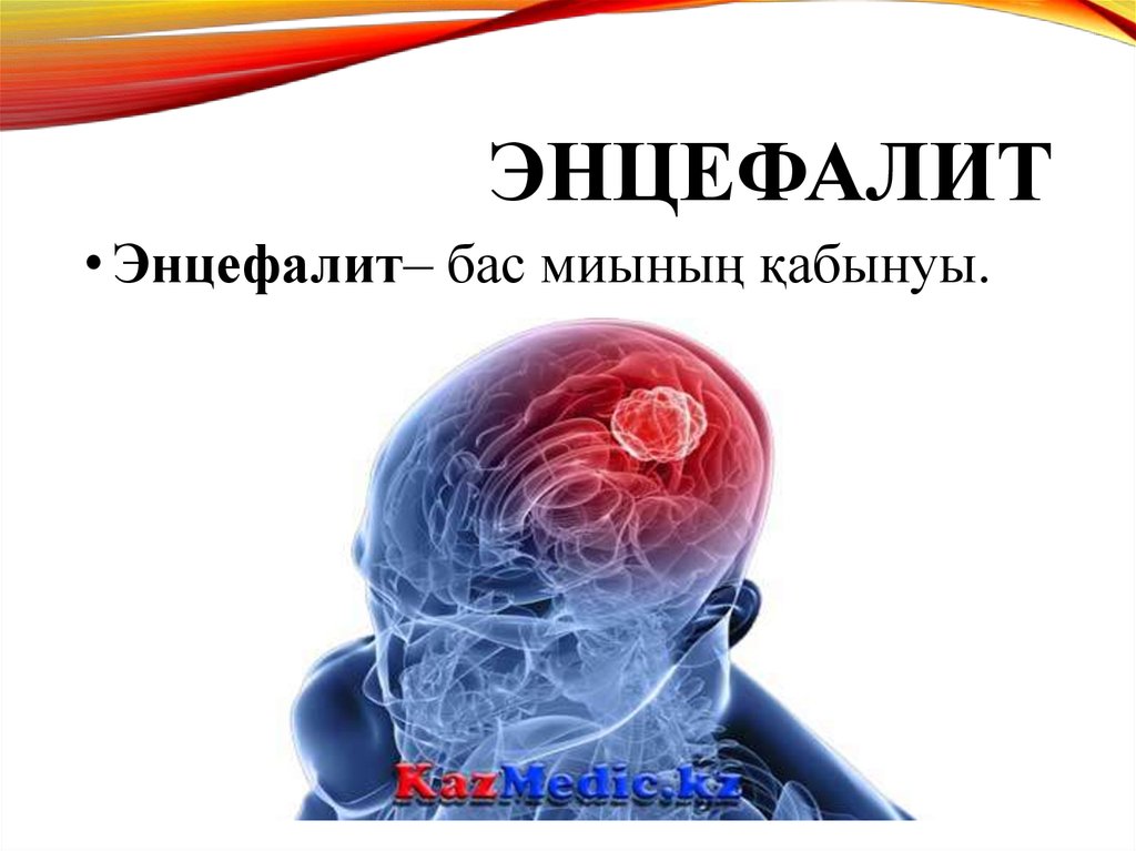 Энцефалит презентация қазақша