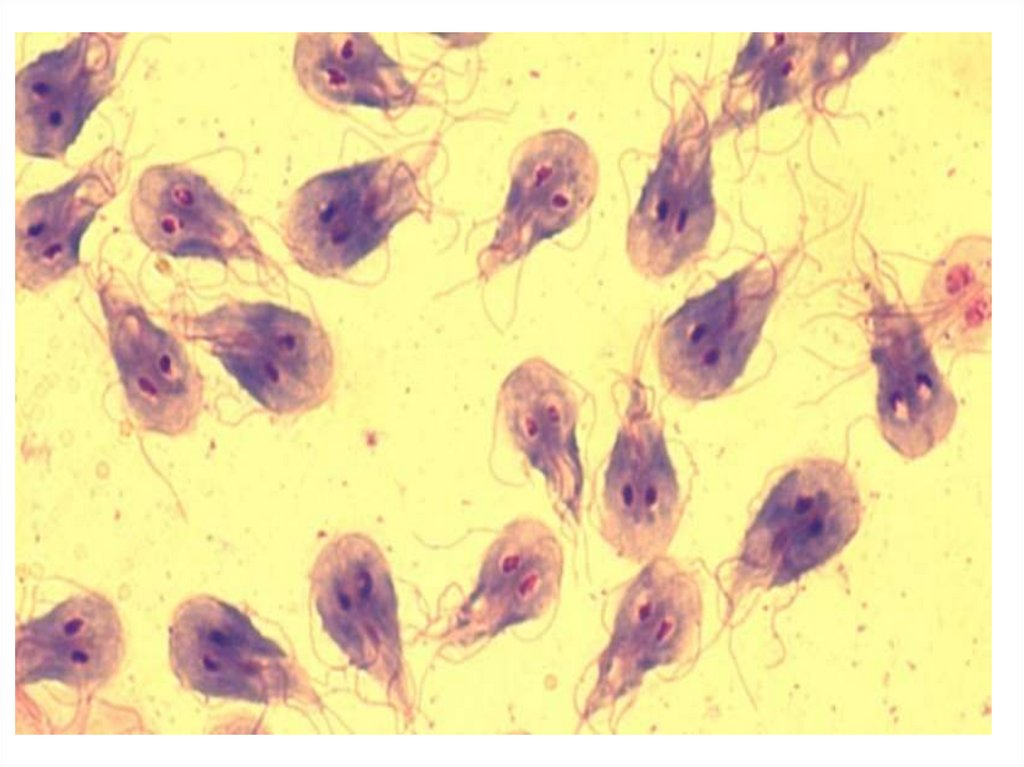 Лямбия. Lamblia intestinalis циста. Гиардия лямблия.