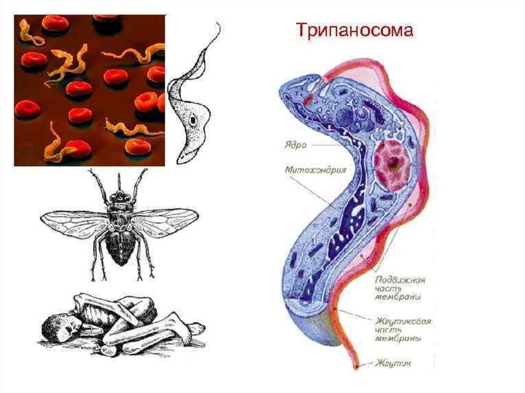 Рассмотрите рисунок с изображением паразитического простейшего какое заболевание развивается