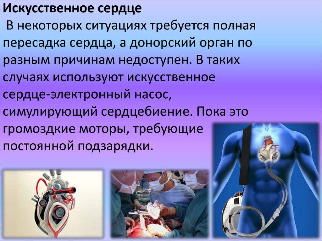 Сколько живет пересаженная. Разработка искусственного сердца. Искусственное сердце. Искусственное сердце трансплантация. Автономное искусственное сердце.