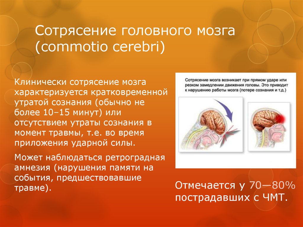 Сотрясение головного мозга (commotio cerebri)