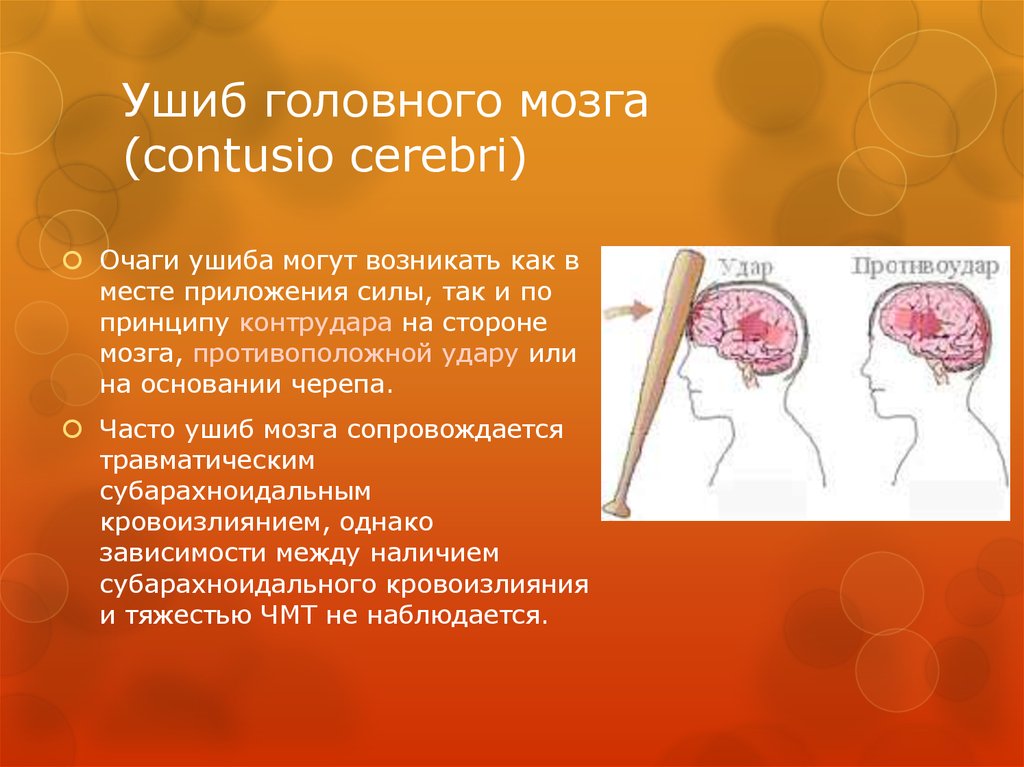 Ушиб головного мозга (contusio cerebri)
