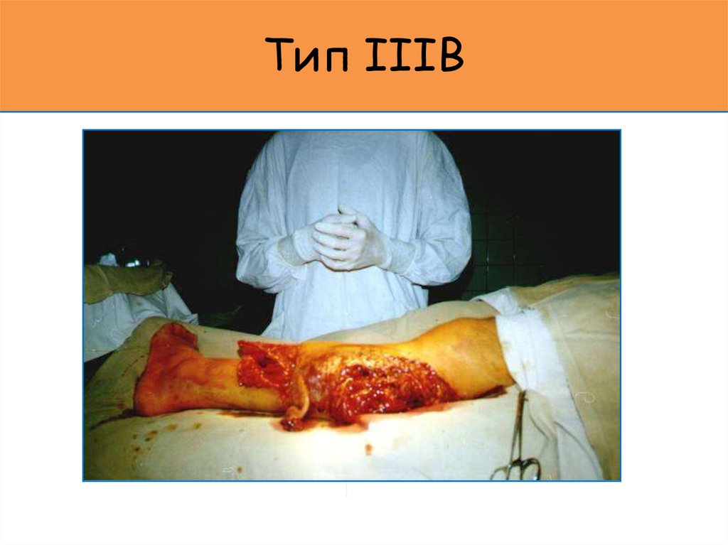 Тип IIIB