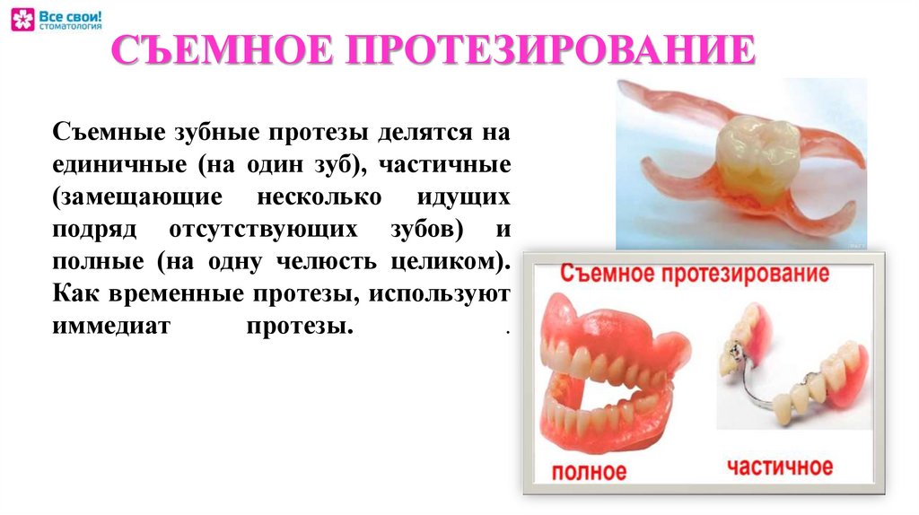 Показания к пластиночным протезам. Классификация иммедиат протезов. Что такое иммедиат протез в стоматологии. Непосредственное протезирование иммедиат протезы.