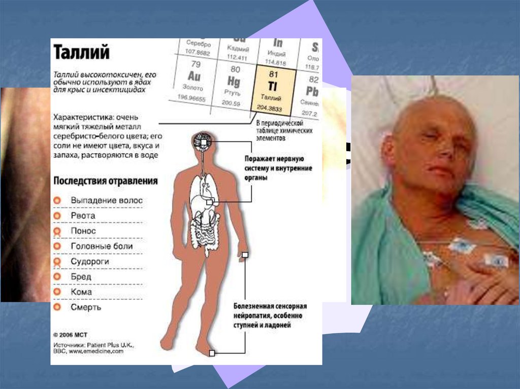 Отравление таллием фото