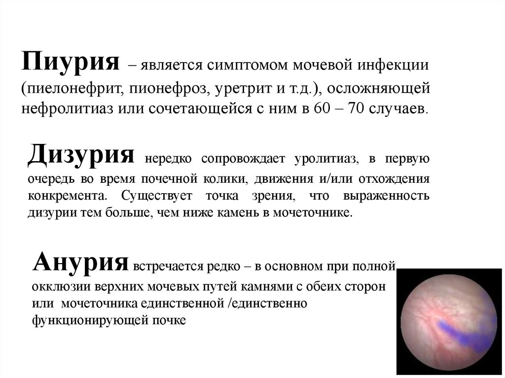 Пиурия. Заболевание сопровождающееся пиурией. Пиурия характерна для. Пиурия причины.