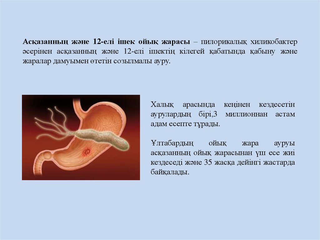 Ішек анатомиясы презентация