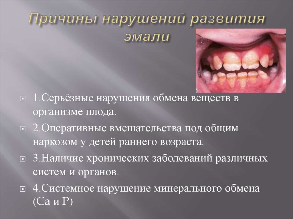 Причины нарушений развития эмали