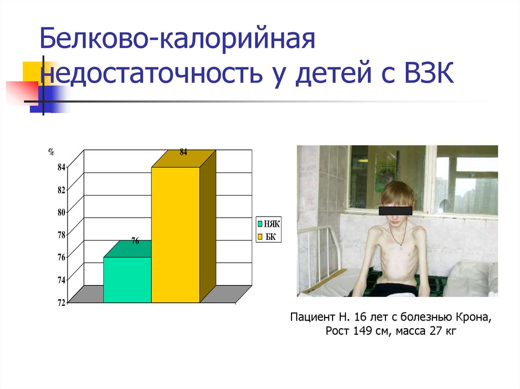 Белково калорийная недостаточность презентация