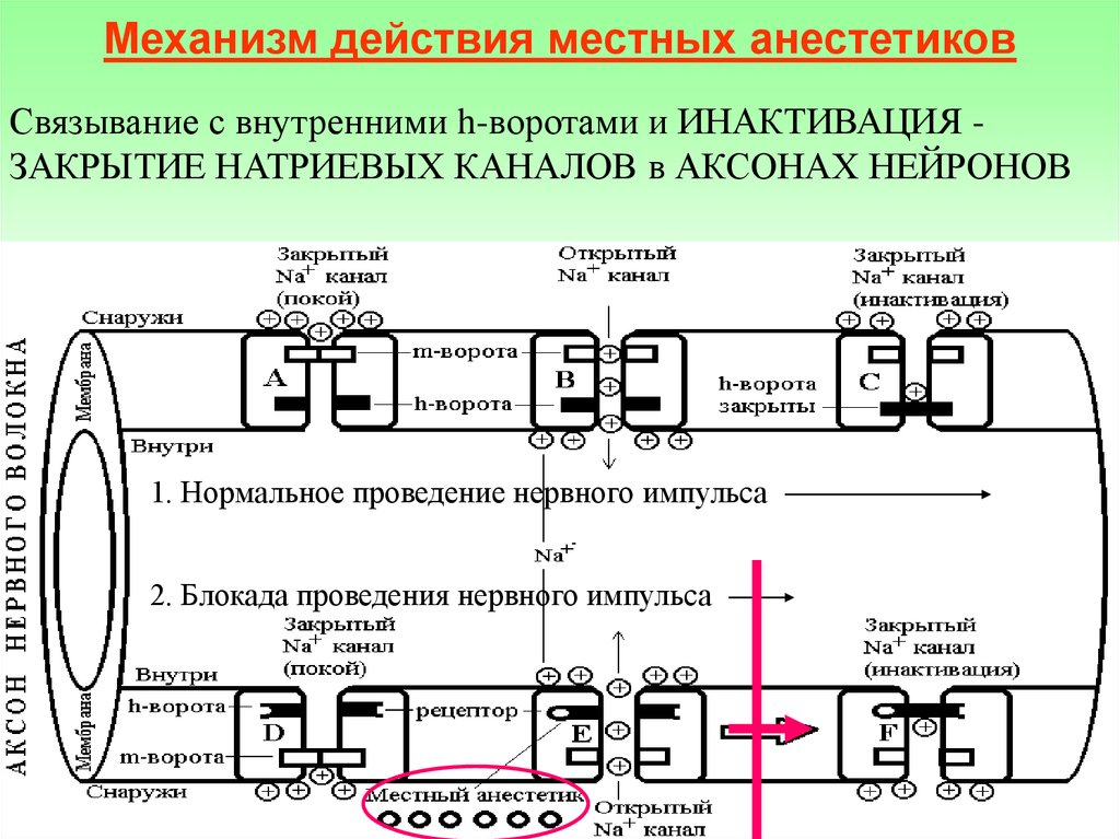 Механизм действия анестезии. Местная анестезия механизм действия. Местные анестетики механизм действия. Механизм действия местного анестетика. Схема действия местных анестетиков.