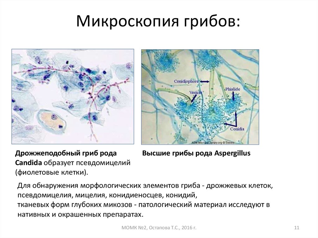 Обнаружены споры и мицелий. Псевдомицелий кандида. Грибы кандида микроскопия. Микроскопия кандиды псевдомицелий. Грибы рода кандида микроскопия.