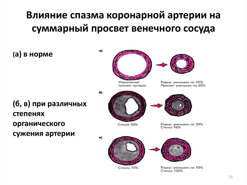 Просвет сосудов. Изменение просвета сосудов. Диаметр просвета сосудов. Просвет кровеносных сосудов. Суммарный просвет артерий.