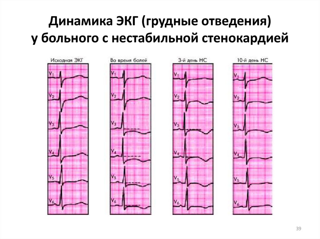 Экг в динамике что это