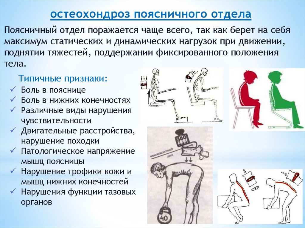 Профилактика остеохондроза презентация