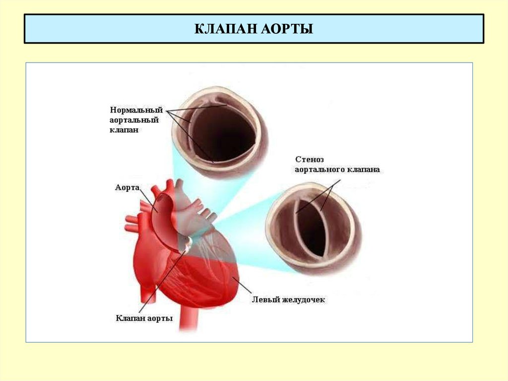 Аортальный клапан картинка