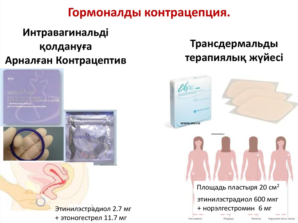 Предохранение после беременности. Гормональная контрацепция. Современные методы контрацепции. Мужские и женские контрацептивы. Оральные методы контрацепции.