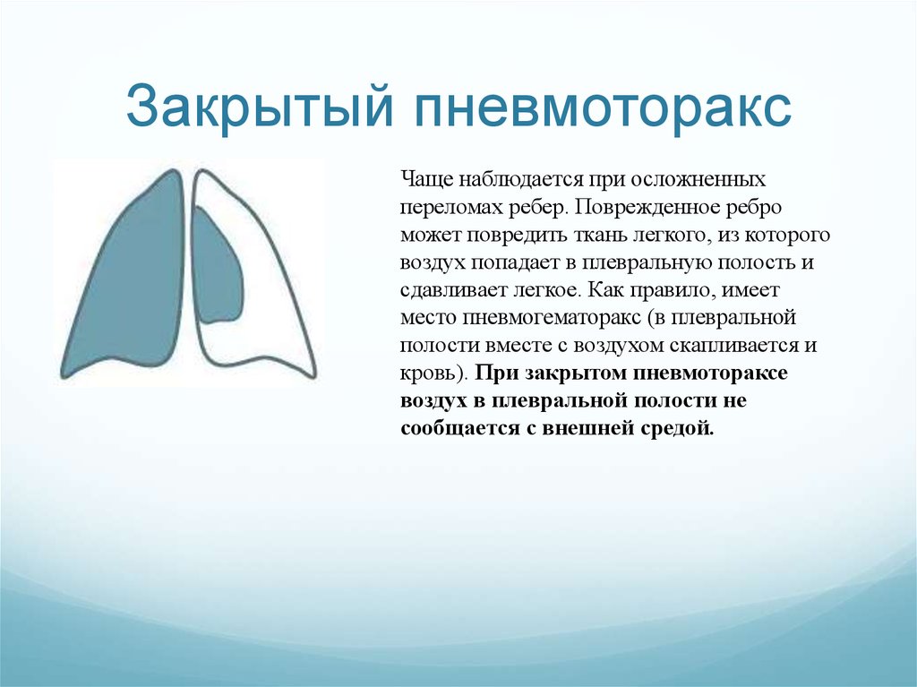 Открытый пневмоторакс. Пневмоторакс открытый закрытый клапанный. Закрытый пневмоторакс. Закрытый пневмоторакс причины. Причины закрытого пневмоторакса.