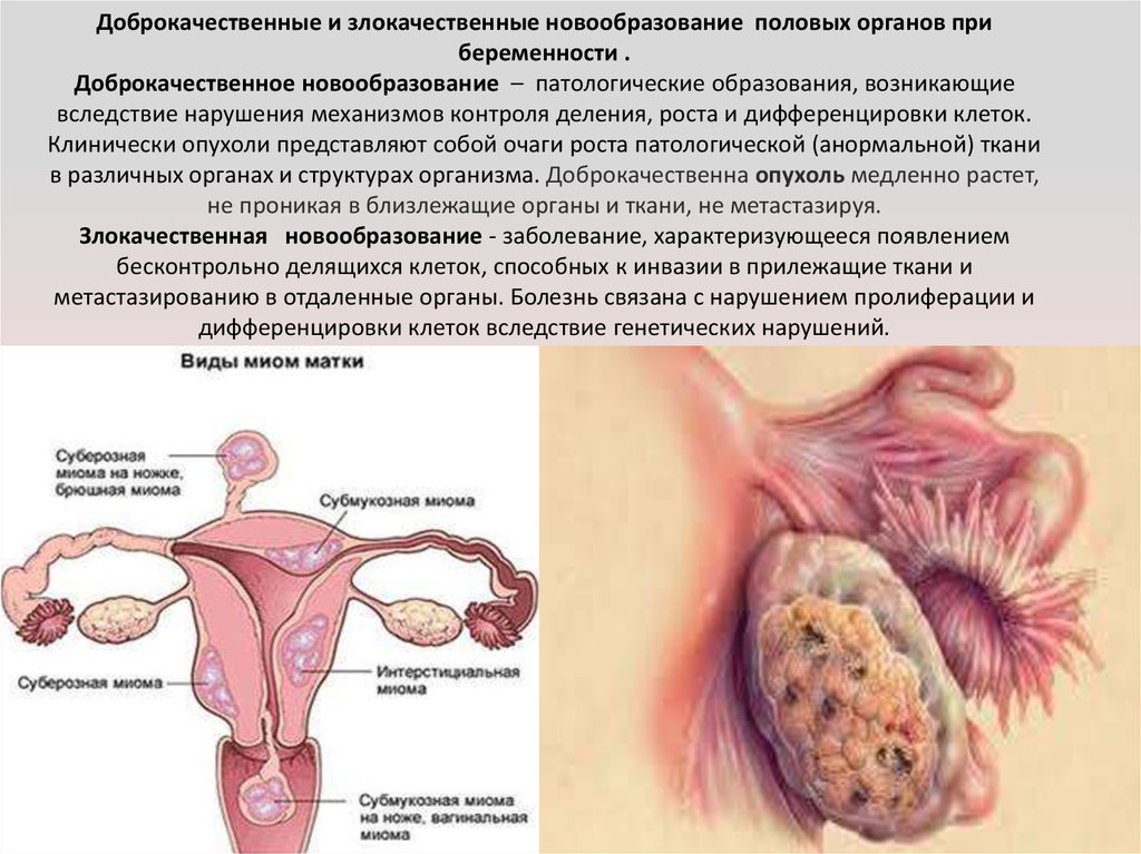 Опущение половых органов у женщин: профилактика, симптомы, диагностика и лечение