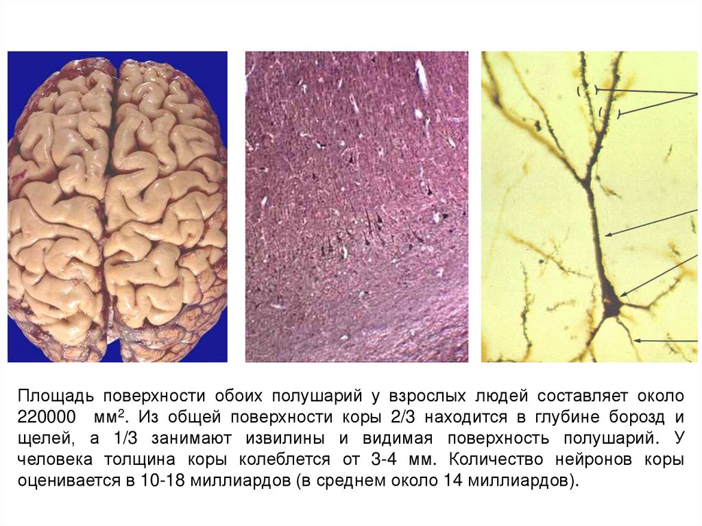 Кора больших полушарий головного мозга рисунок гистология