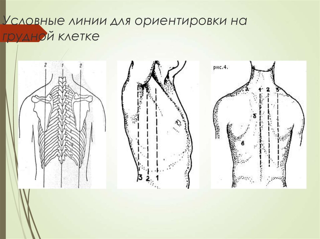 Площадь поверхности грудной клетки у человека. Топографические линии грудной клетки. Топографические линии грудной клетки схема. Топографические линии тела человека анатомия. Грудная клетка спереди топографические линии.