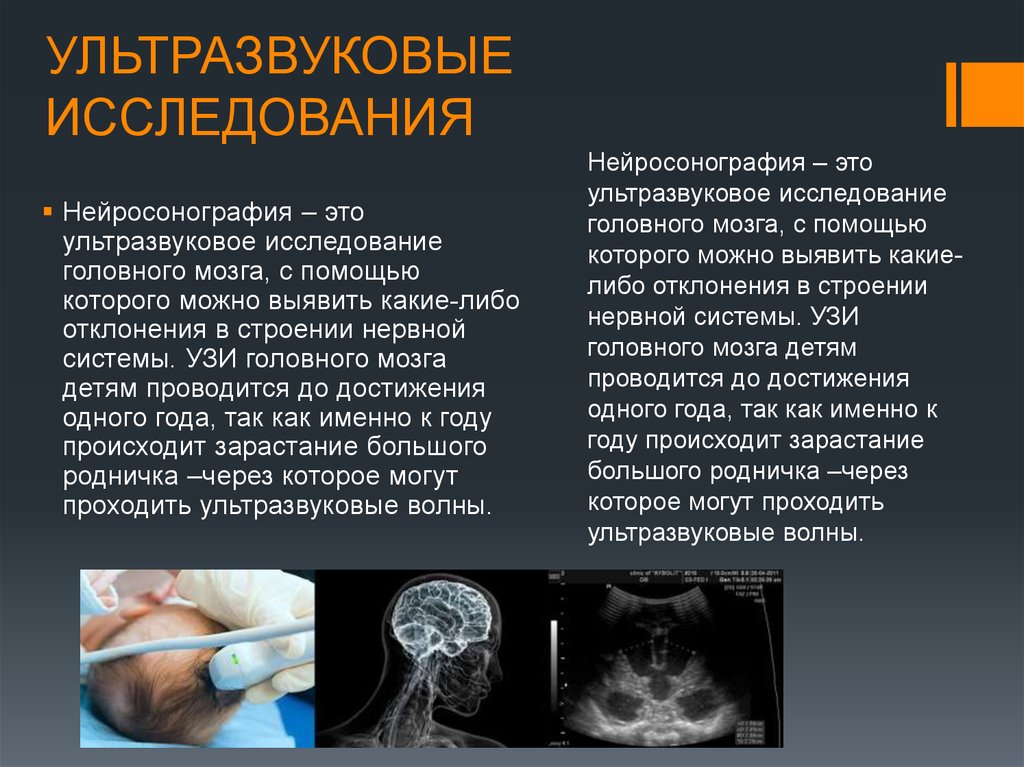 Узи родничка. УЗИ головного мозга нейросонография. Нейросонография презентация. Ультразвуковое исследование. Нейросонография анатомия.