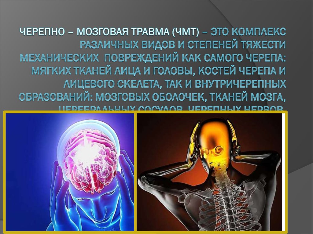 Черепно – мозговая травма (ЧМТ) – это комплекс различных видов и степеней тяжести механических повреждений как самого черепа: