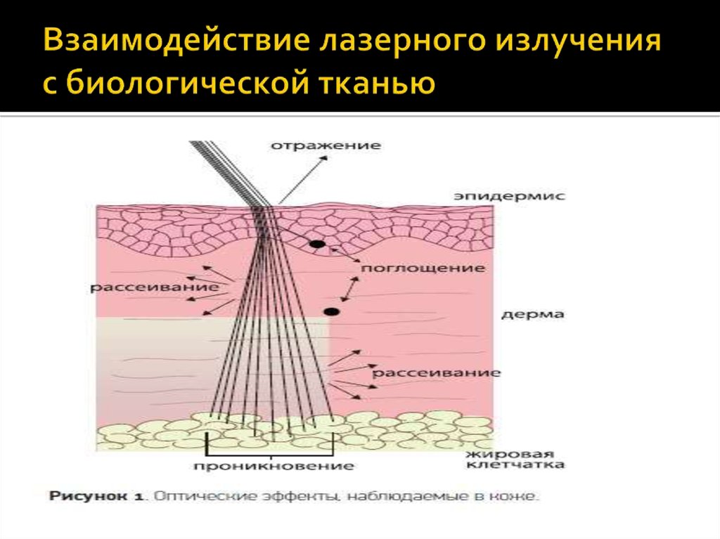 На рисунке представлены эффекты высокоинтенсивного лазерного излучения на биологические ткани где