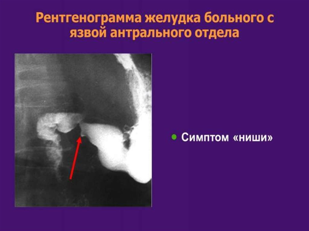 Рентгенография желудка презентация