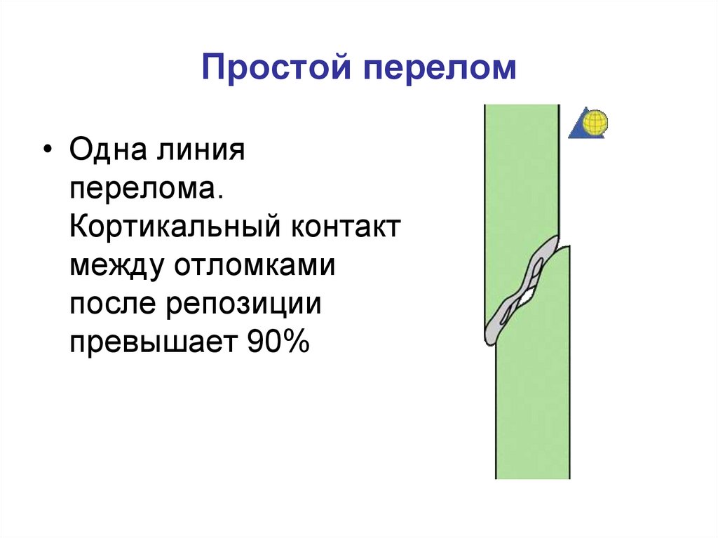 Перелом это