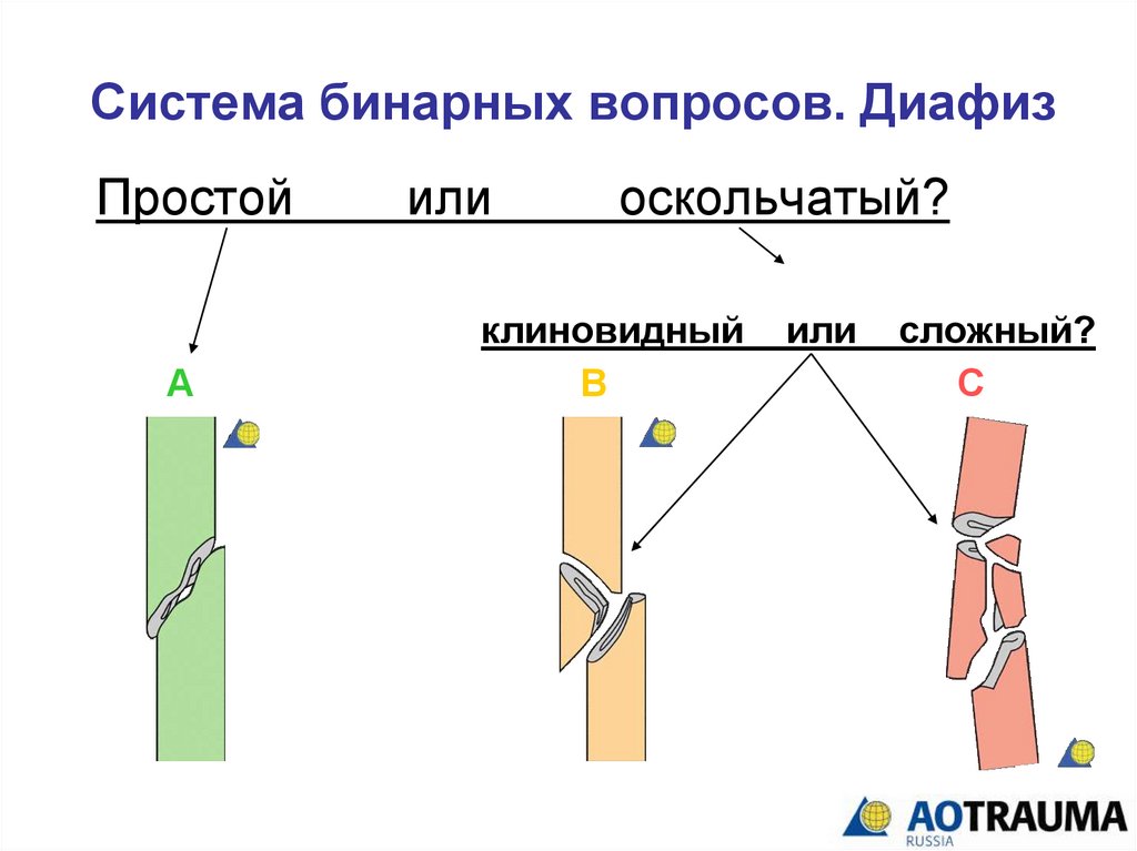 Система бинарных вопросов. Диафиз
