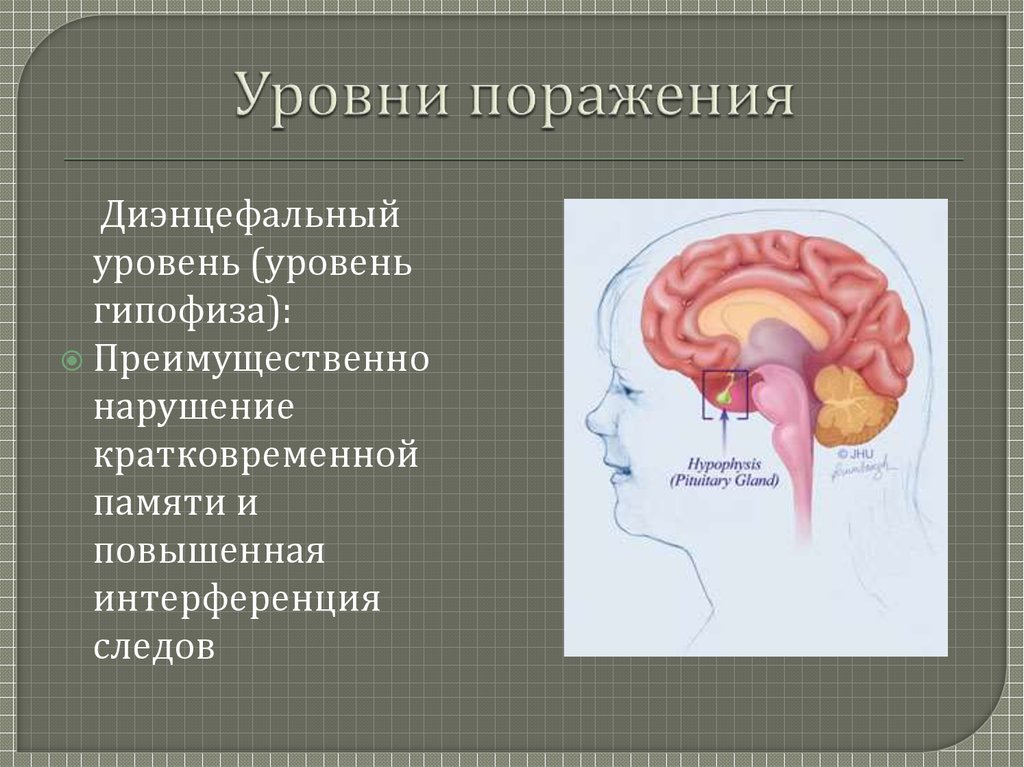 Диэнцефальная дисфункция головного мозга. Диэнцефальные структуры. Диэнцефальные структуры мозга. Диэнцефальные отделы мозга это. Гипоталамо диэнцефальные структуры.